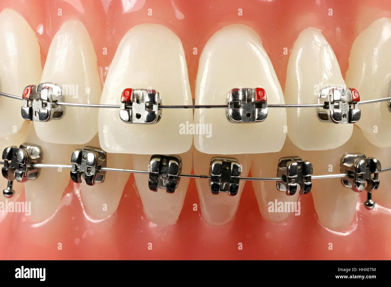 Dental Photo