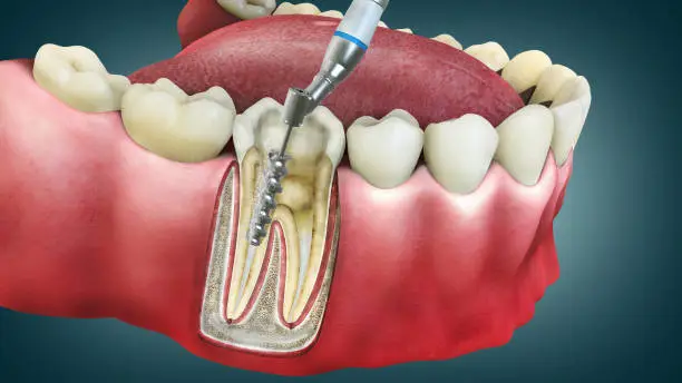 Dental Photo