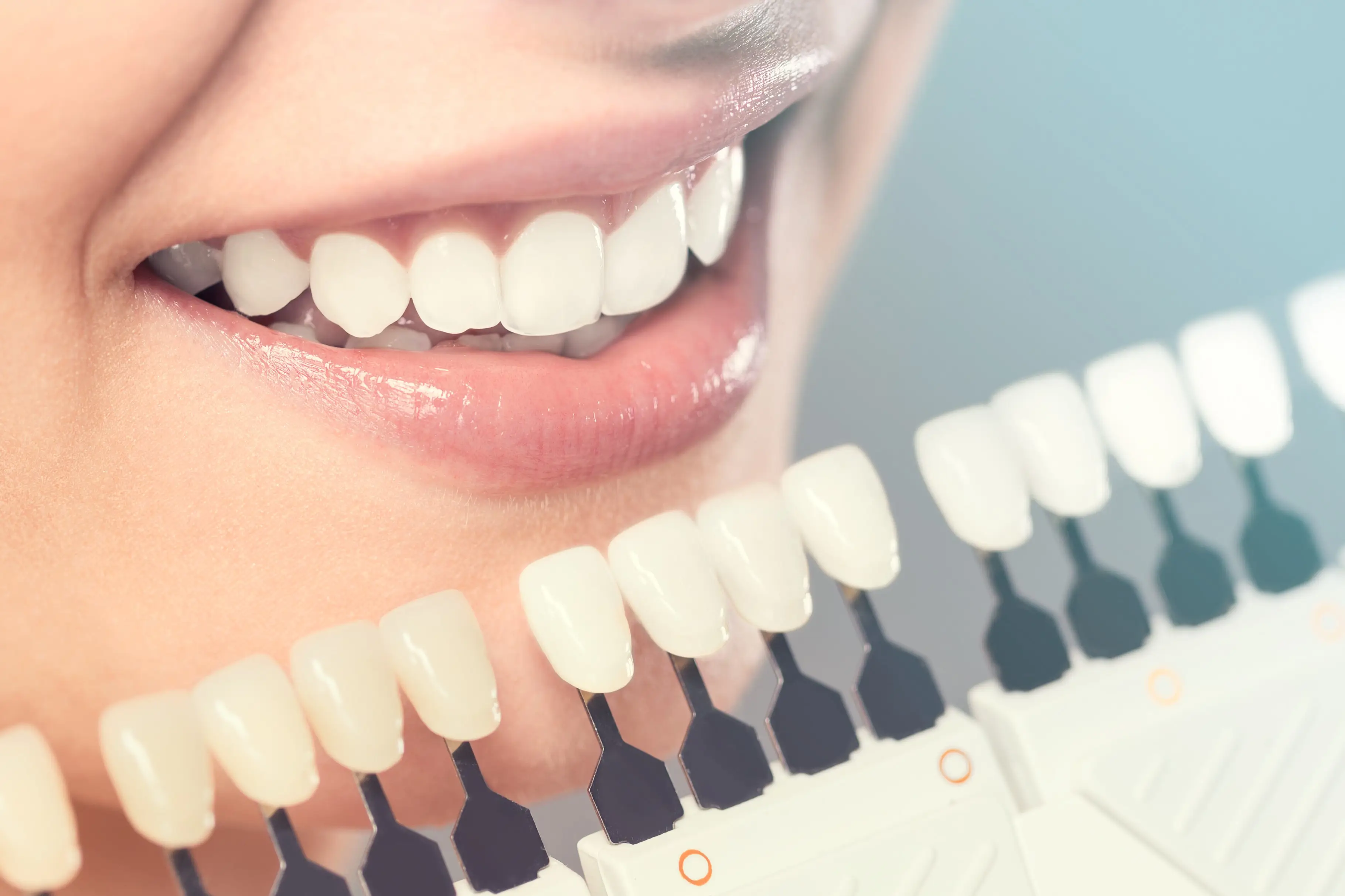 Dental Photo