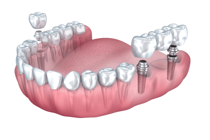 Dental Photo
