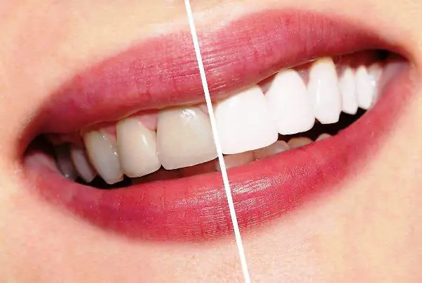 Dental Photo