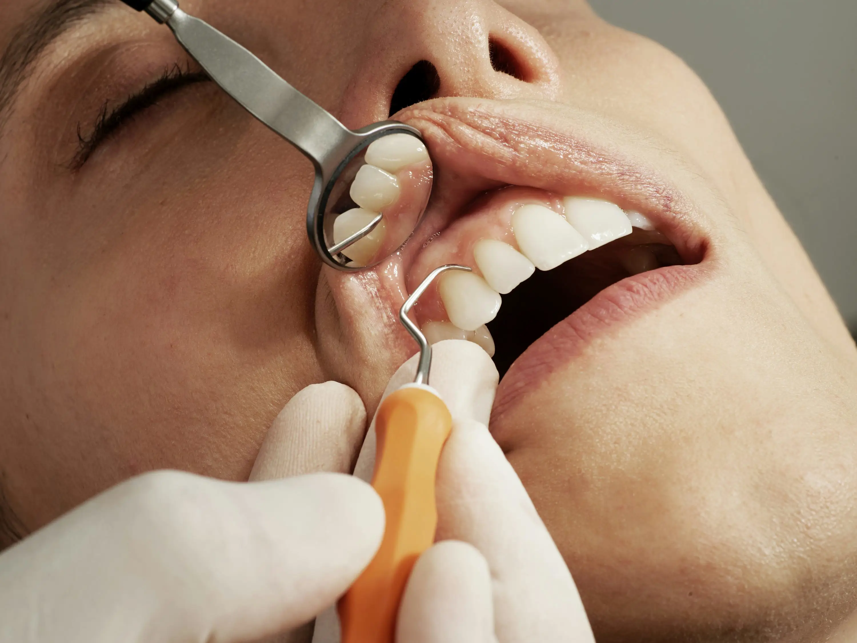 Dental Photo