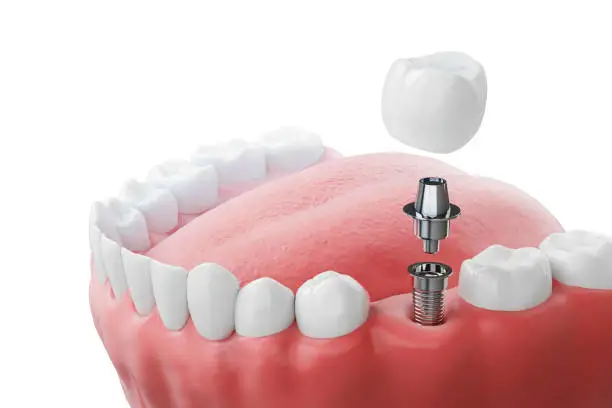 Dental Photo